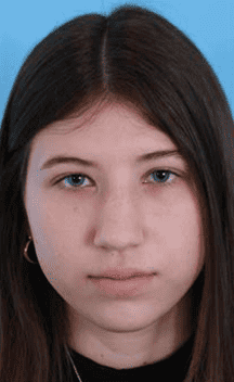 Before Image: Rhinoplasty - front